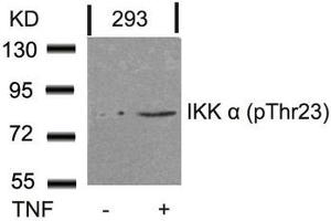 Western blot analysis of extracts from 293 cells untreated or treated with TNF using IKK a(Phospho-Thr23) Antibody. (IKK alpha 抗体  (pThr23))