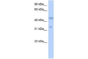 Western Blotting (WB) image for anti-Epidermal Retinal Dehydrogenase 2 (RDHE2) antibody (ABIN2459555) (SDR16C5 抗体)