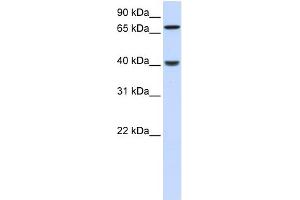 WB Suggested Anti-PDLIM3 Antibody Titration: 0.