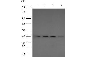 All lanes : BMP6 Rabbit mAb at 1/1k dilution Lane 1 : Mouse Lung lysates Lane 2 : Rat Brain lysates Lane 2 : Rat Kidney lysates Lane 3 : Rat Lung lysates Lysates/proteins at 20 μg per lane. (Recombinant BMP6 抗体)
