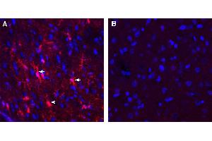 Expression of GPR12 in rat cortex. (G Protein-Coupled Receptor 12 抗体  (Extracellular))