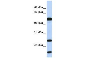 UBE2L6 antibody used at 1 ug/ml to detect target protein. (UBE2L6 抗体  (N-Term))