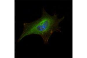 Immunofluorescence analysis of NIH/3T3 cells using FMR1 mouse mAb (green). (FMR1 抗体)
