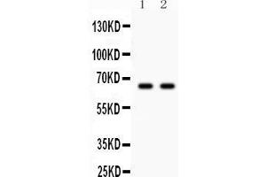 Western blot testing of Parkin antibody and Lane 1:  U87;  2: mouse brain lysate. (Parkin 抗体  (AA 23-416))