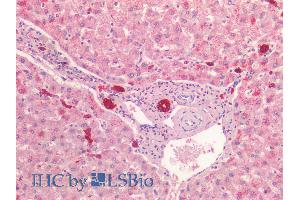 ABIN1781977 (5µg/ml) staining of paraffin embedded Human Liver. (Cytokeratin 19 抗体  (C-Term))