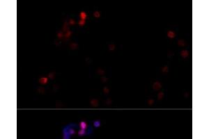 Immunofluorescence analysis of NIH/3T3 cells using TBP Polyclonal Antibody at dilution of 1:100 (40x lens). (TBP 抗体)