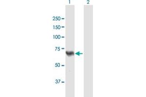 Western Blot analysis of ACSL5 expression in transfected 293T cell line by ACSL5 MaxPab polyclonal antibody. (ACSL5 抗体  (AA 1-739))