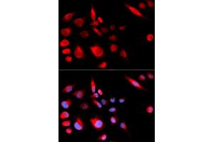 Immunofluorescence analysis of U2OS cells using KIF2C antibody (ABIN5973166). (KIF2C 抗体)