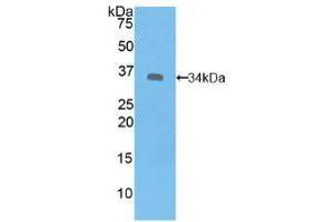 Western blot analysis of recombinant Human SYK. (SYK 抗体  (AA 374-635))