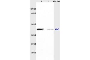 Lane 1: rat brain lysates Lane 2: rat heart lysates probed with Anti CK II alpha/STKPolyclonal Antibody, Unconjugated (ABIN731978) at 1:200 in 4 °C. (CSNK2A1/CK II alpha 抗体  (AA 201-300))