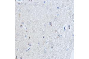 Immunohistochemistry (IHC) image for anti-Ral Guanine Nucleotide Dissociation Stimulator (RALGDS) antibody (ABIN7269838)