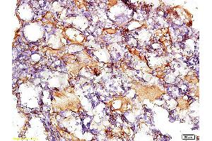 Formalin-fixed and paraffin embedded rat liver tissue with Anti-Collagen IV Polyclonal Antibody, Unconjugated (ABIN728413) at 1:200, followed by conjugation to the secondary antibody and DAB staining (Collagen IV 抗体  (AA 1401-1500))