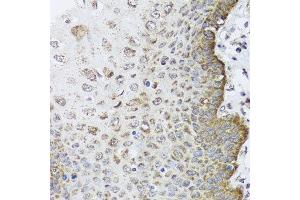 Immunohistochemistry of paraffin-embedded human esophagus using FANCL antibody at dilution of 1:100 (x40 lens).