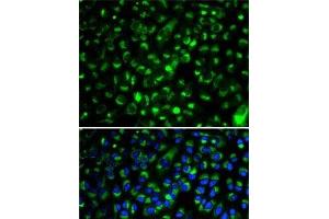 Immunofluorescence analysis of HeLa cells using CYP2E1 Polyclonal Antibody (CYP2E1 抗体)