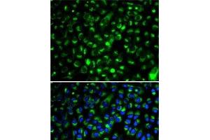 Immunofluorescence (IF) image for anti-Cytochrome P450, Family 2, Subfamily E, Polypeptide 1 (CYP2E1) antibody (ABIN7260247)