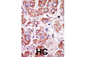 Immunohistochemistry (IHC) image for anti-Plasminogen Activator, Urokinase Receptor (PLAUR) antibody (ABIN3003728) (PLAUR 抗体)