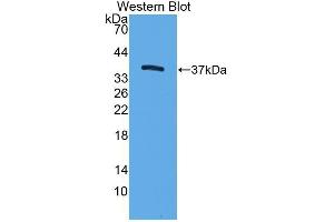 Western Blotting (WB) image for anti-Trefoil Factor 3 (Intestinal) (TFF3) antibody (Biotin) (ABIN1174902) (TFF3 抗体  (Biotin))
