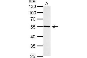Western Blotting (WB) image for anti-Cytochrome P450, Family 1, Subfamily B, Polypeptide 1 (CYP1B1) (Center) antibody (ABIN2855824)