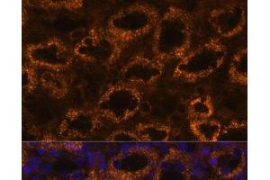 Immunofluorescence analysis of Rat kidney using SLC7A9 Polyclonal Antibody at dilution of 1:100. (SLC7A9 抗体)