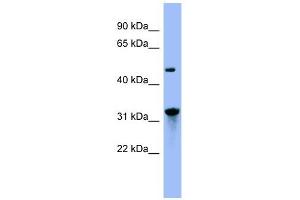 NIT1 antibody used at 1 ug/ml to detect target protein. (Nitrilase 1 抗体  (N-Term))