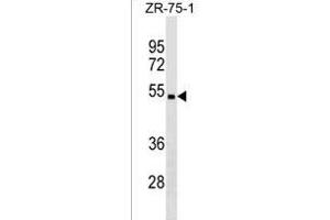 CHST5 Antibody (C-term) (ABIN1536997 and ABIN2850338) western blot analysis in ZR-75-1 cell line lysates (35 μg/lane). (CHST5 抗体  (C-Term))