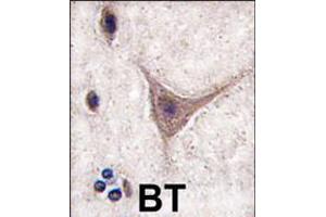 Formalin-fixed and paraffin-embedded human brain tissue reacted with CDH10 antibody , which was peroxidase-conjugated to the secondary antibody, followed by DAB staining. (CDH10 抗体  (C-Term))