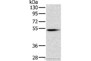 Western blot analysis of Mouse pancreas tissue, using PNLIP Polyclonal Antibody at dilution of 1:400 (PNLIP 抗体)
