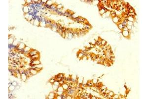 Immunohistochemistry of paraffin-embedded human small intestine tissue using ABIN7160672 at dilution of 1:100 (GALK2 抗体  (AA 161-458))