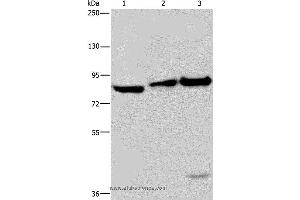 Western blot analysis of NIH/3T3 cell, mouse lung and liver tissue, using ECE1 Polyclonal Antibody at dilution of 1:550 (ECE1 抗体)