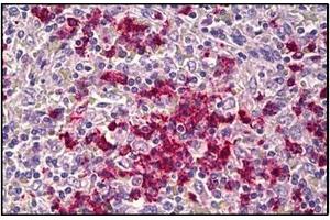 Human Spleen: Formalin-Fixed, Paraffin-Embedded (FFPE) (CDH23 抗体  (N-Term))