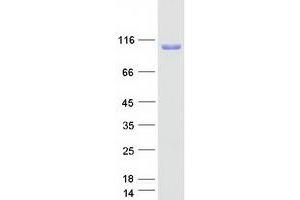 Western Blotting (WB) image for Nucleolar Protein 4 (NOL4) protein (Myc-DYKDDDDK Tag) (ABIN2727448)
