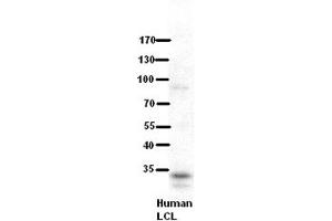 WB Suggested Anti-RRP1B Antibody Titration:  5% Milk  ELISA Titer:  dilution: 1:500  Positive Control:  human LCL (RRP1B 抗体  (Middle Region))
