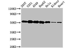 Western Blot Positive WB detected in: 293T whole cell lysate, U251 whole cell lysate, A549 whole cell lysate, HepG2 whole cell lysate, Hela whole cell lysate, Rat kidney tissue, Mouse heart tissue All lanes: SLC25A24 antibody at 5 μg/mL Secondary Goat polyclonal to rabbit IgG at 1/50000 dilution Predicted band size: 54, 52 kDa Observed band size: 54 kDa (SLC25A24 抗体  (AA 1-197))