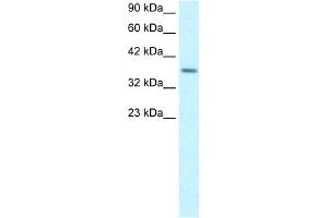 WB Suggested Anti-RPS16 Antibody Titration:  1. (RPS16 抗体  (Middle Region))
