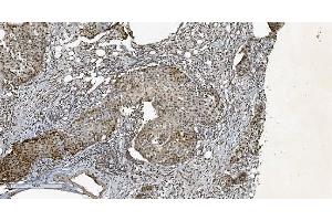 IHC analysis of HP1 alpha/CBX5 using anti-HP1 alpha/CBX5 antibody (ABIN7599057).