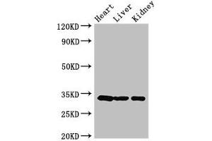 Western Blot Positive WB detected in: Mouse heart tissue, Mouse liver tissue, Mouse kidney tissue All lanes: CCND2 antibody at 3. (Cyclin D2 抗体  (AA 215-285))