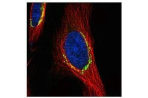 ICC/IF Image Confocal immunofluorescence analysis (Olympus FV10i) of paraformaldehyde-fixed HeLa, using COPD, antibody (green) at 1:500 dilution. (ARCN1 抗体)