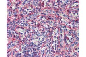 Immunohistochemistry (IHC) image for anti-Kinesin Family Member 20A (KIF20A) (Middle Region) antibody (ABIN2792240)