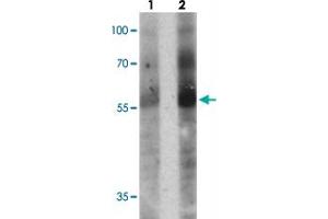 Western blot analysis of TOX in human colon tissue with TOX polyclonal antibody  at (1) 1 and (2) 2 ug/mL. (TOX 抗体  (N-Term))
