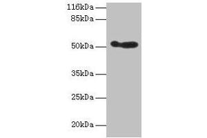 Western blot All lanes: ALDH3A1 antibody at 2 μg/mL + 293T whole cell lysate Secondary Goat polyclonal to rabbit IgG at 1/10000 dilution Predicted band size: 51 kDa Observed band size: 51 kDa (ALDH3A1 抗体  (AA 210-453))
