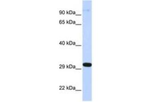 Image no. 1 for anti-Zinc Finger Protein 688 (ZNF688) (AA 72-121) antibody (ABIN6742728) (ZNF688 抗体  (AA 72-121))
