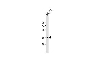 Anti-MFRN2 Antibody (N-term) at 1:2000 dilution + MCF-7 whole cell lysate Lysates/proteins at 20 μg per lane. (SLC25A28 抗体  (N-Term))
