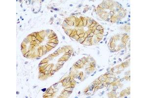 Immunohistochemistry of paraffin-embedded Human stomach using NCAM1 / CD56 Polyclonal Antibody at dilution of 1:100 (40x lens). (CD56 抗体)