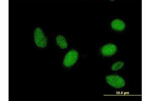 Immunofluorescence of purified MaxPab antibody to RNF36 on HeLa cell. (TRIM69 抗体  (AA 1-341))
