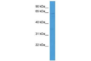 WB Suggested Anti-MRGPRX2 Antibody Titration: 0. (MRGPRX2 抗体  (Middle Region))