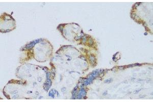 Immunohistochemistry of paraffin-embedded Human placenta using CYP11A1 Polyclonal Antibody at dilution of 1:150 (40x lens). (CYP11A1 抗体)
