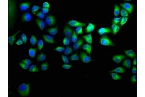 Immunofluorescence staining of Hela cells with ABIN7144218 at 1:100, counter-stained with DAPI. (ANKRD2 抗体  (AA 1-210))