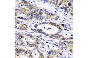 Immunohistochemistry (Paraffin-embedded Sections) (IHC (p)) image for anti-Ribophorin 1 (RPN1) (AA 20-280) antibody (ABIN6147170)