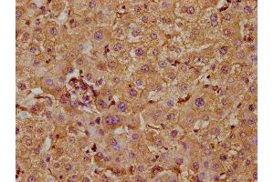 IHC image of ABIN7169187 diluted at 1:300 and staining in paraffin-embedded human liver tissue performed on a Leica BondTM system. (TAO Kinase 1 (TAOK1) (AA 400-659) 抗体)
