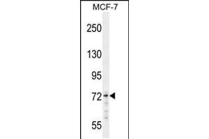 Western blot analysis in MCF-7 cell line lysates (35ug/lane). (MED25 抗体  (N-Term))